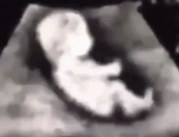 微信图片_20210311162904.gif