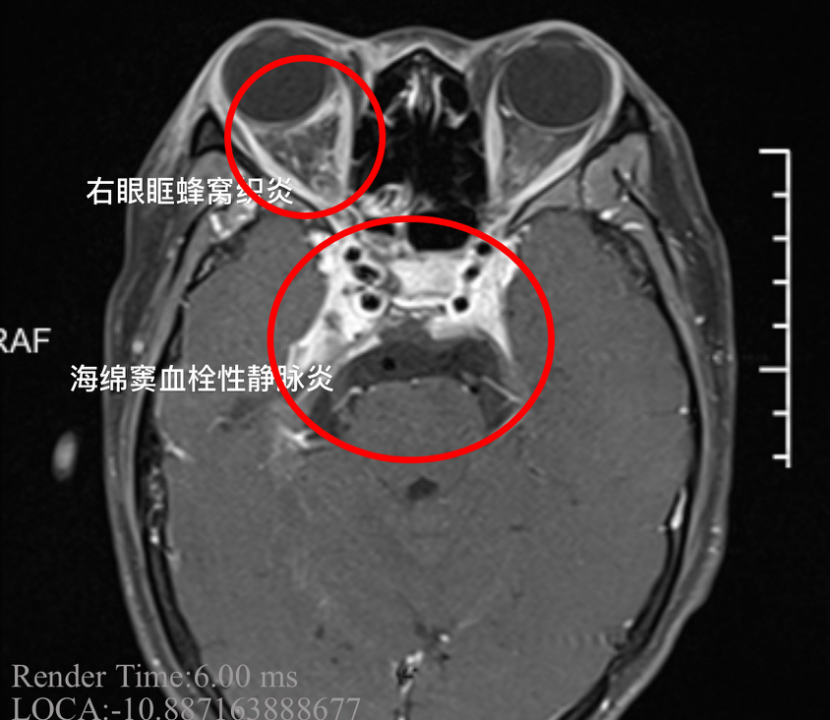 微信图片_20200907134440.png