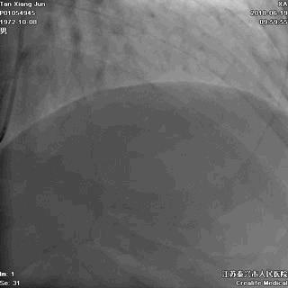 8.gif