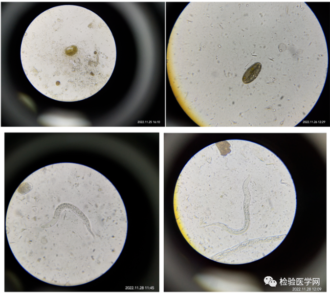 把新鲜粪便放置28度孵箱过夜,可见较多含幼虫的卵细胞和1