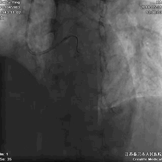 2.gif