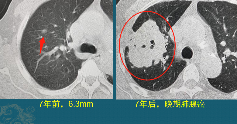 微信图片_20201125100855.png