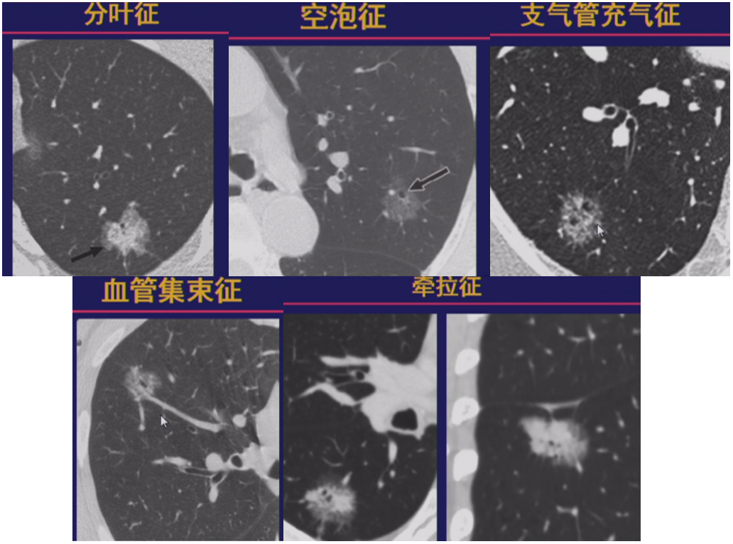 微信图片_20201118102052.png