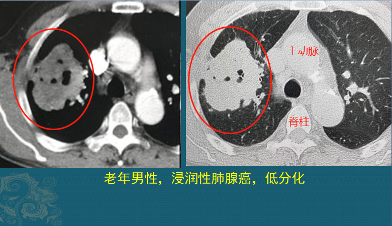 微信图片_20201125100345.png