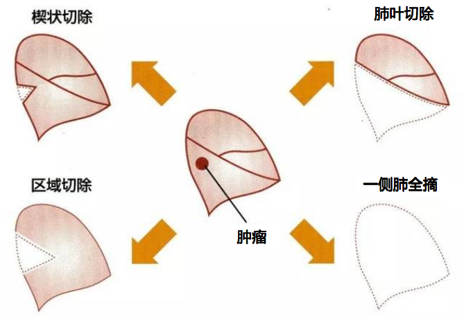 微信图片_20201228111722.png