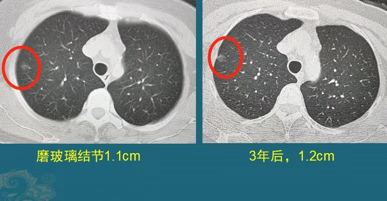 微信图片_20201125100723.png