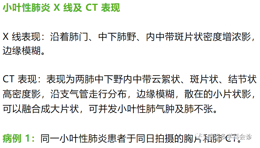 一文搞定不同类型肺部感染的ct征象与鉴别诊断