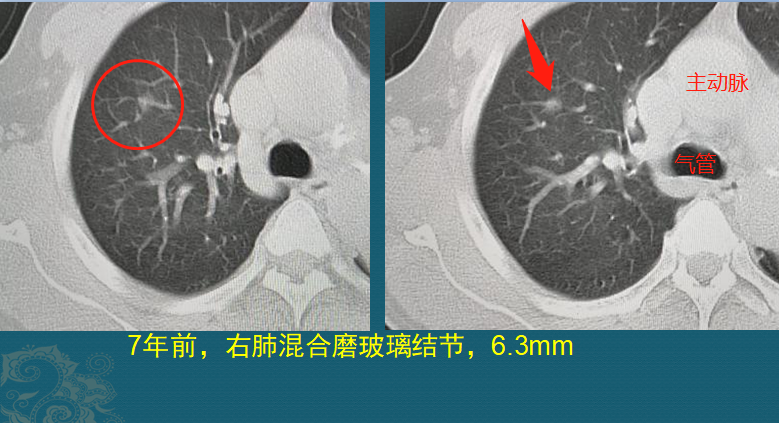 微信图片_20201125100350.png