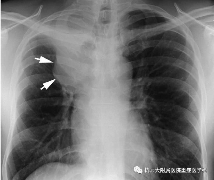微信图片_20220301103120.png