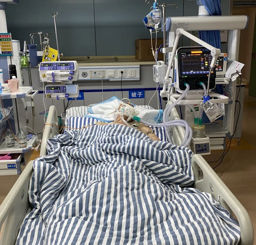 vap英文名为ventilator associated pneumonia, 是医院获得性肺炎