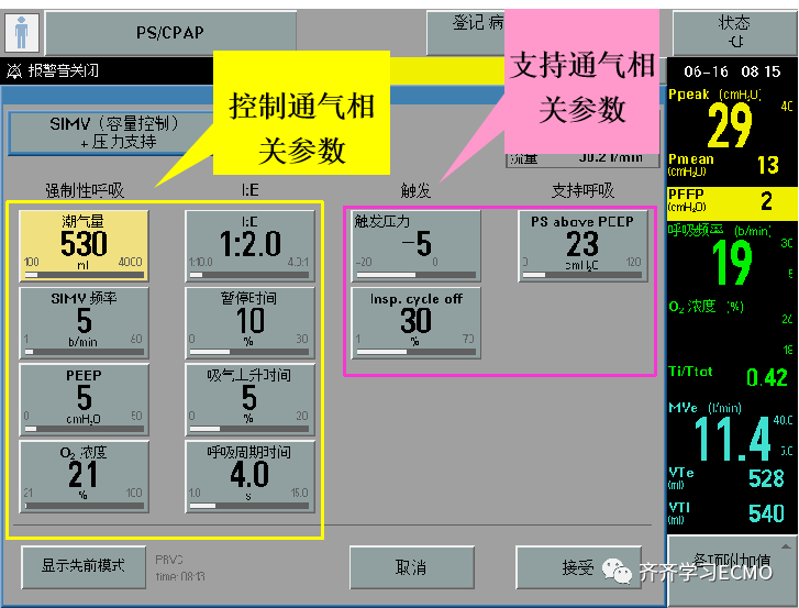 幫助我很好理解simv的,是這款呼吸機(圖3,以maquet 的servo i/s為例)