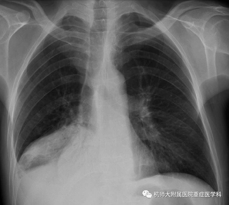 微信图片_20220301103121.png