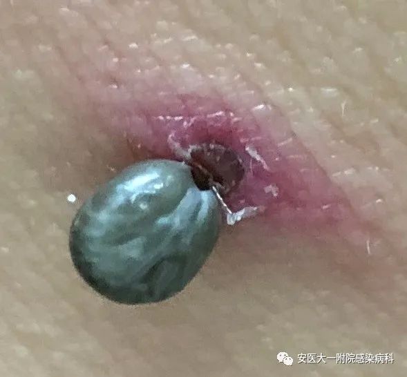 微信图片_20220606094450.jpg