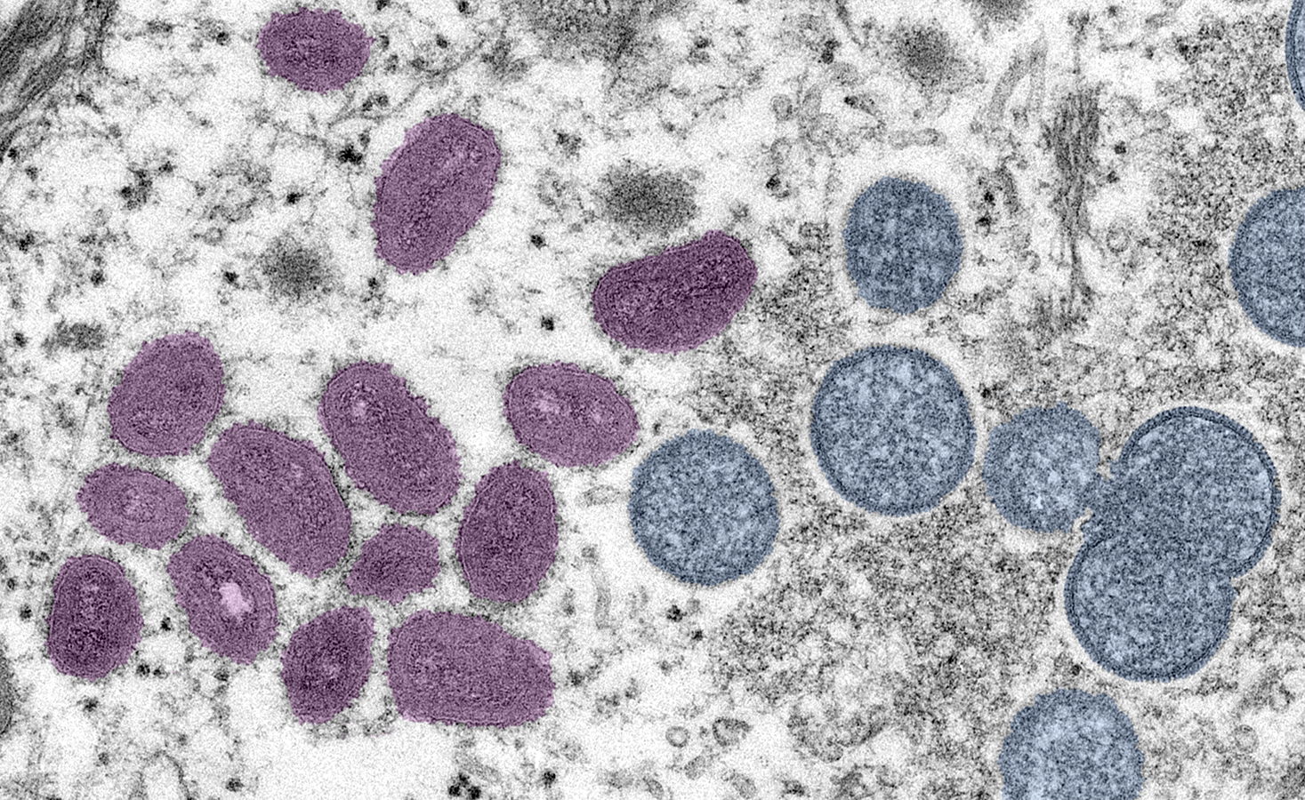 monkeypox-colorized.png