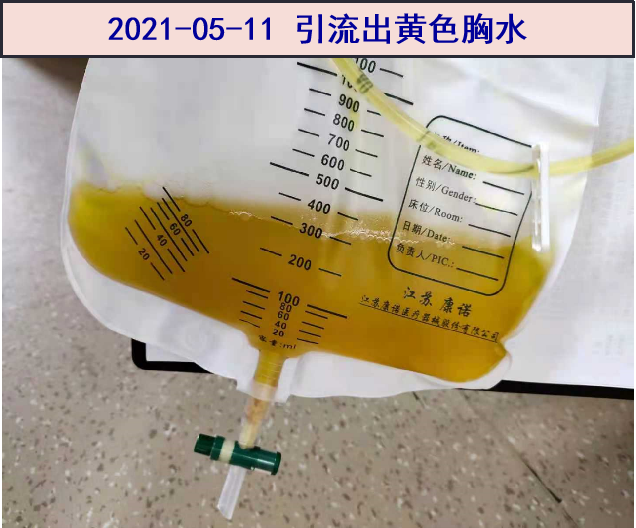 引流液.png