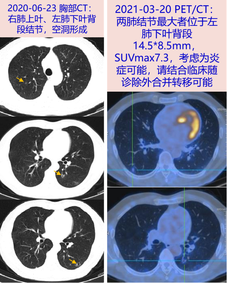 合12.png