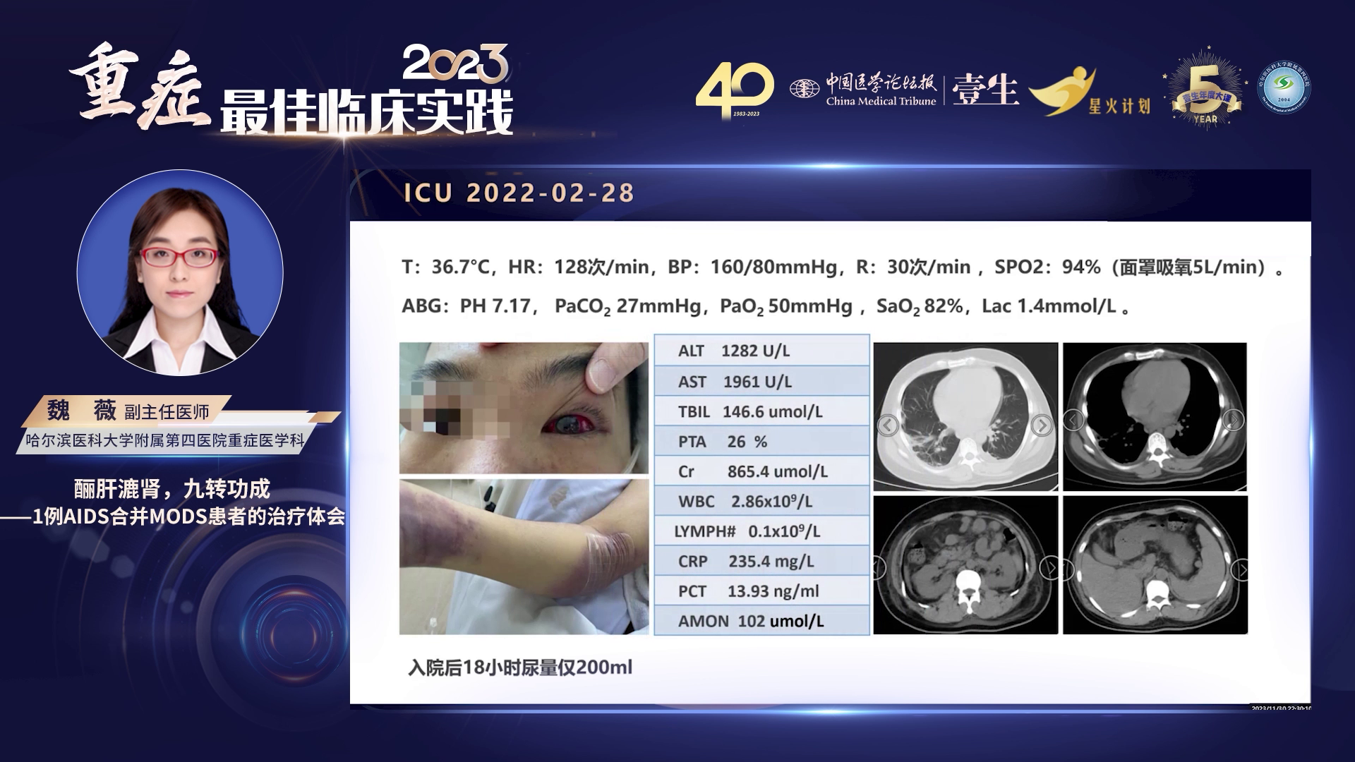 upfile slide_0013.png