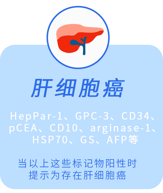 5555555555555.png