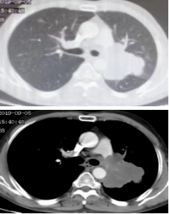 CT1.png