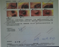 电子支气管.png