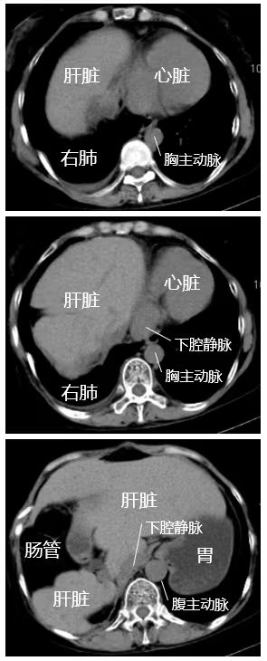 长海病例术后影像.jpg