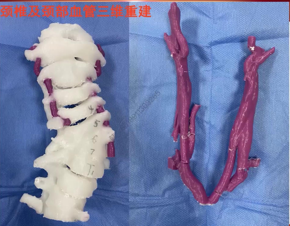 upfile 图片 13.png