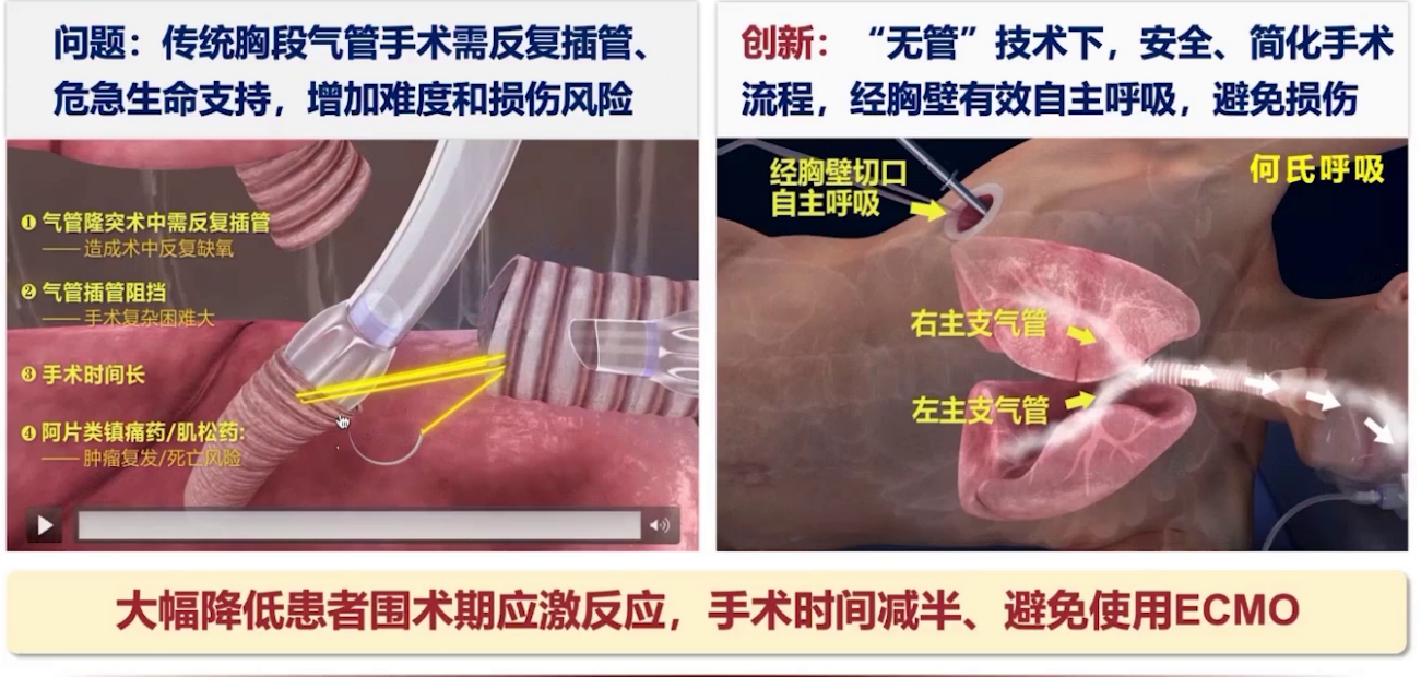 upfile 图片 11.png