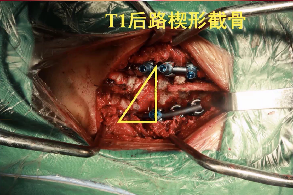 upfile 图片 23.png