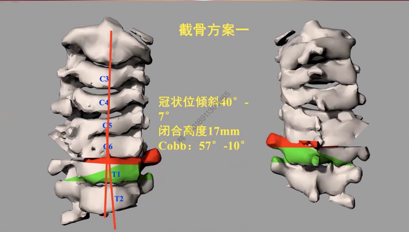 upfile 图片 18.png