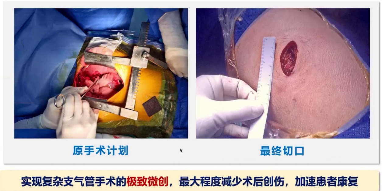 upfile 图片 12.png