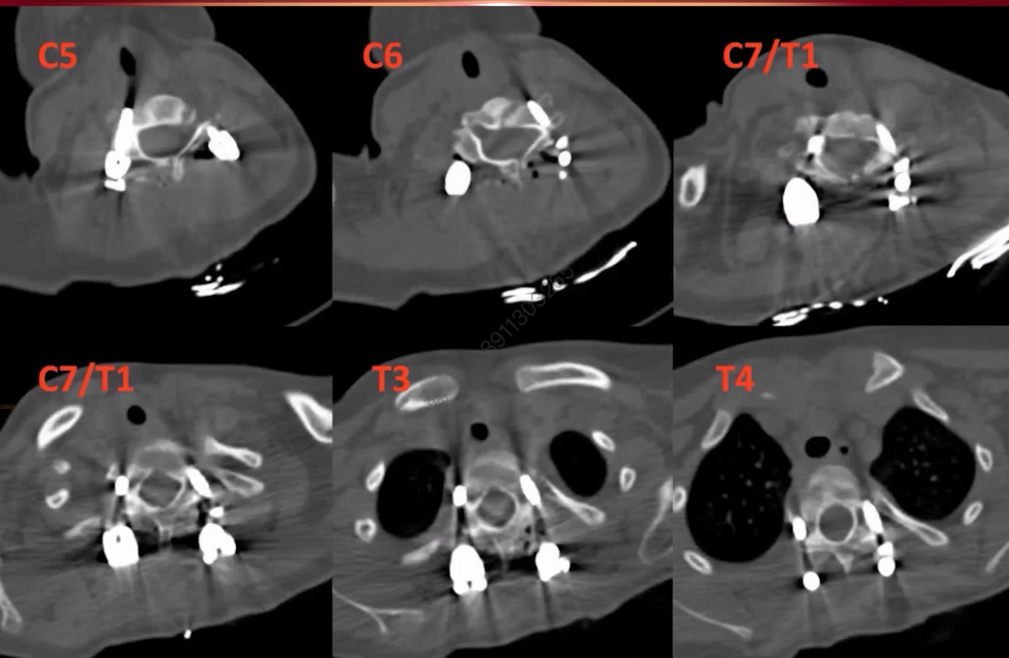 upfile 图片 25.png