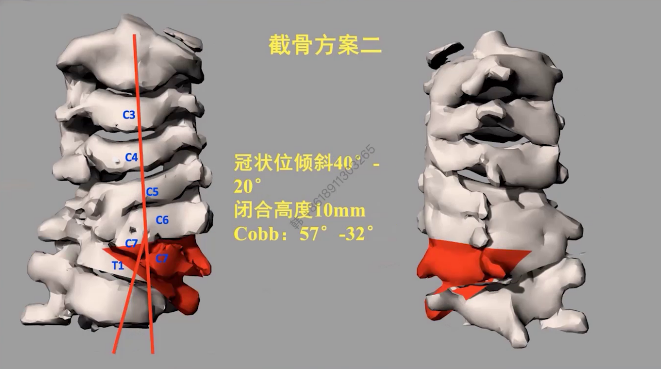 upfile 图片 19.png