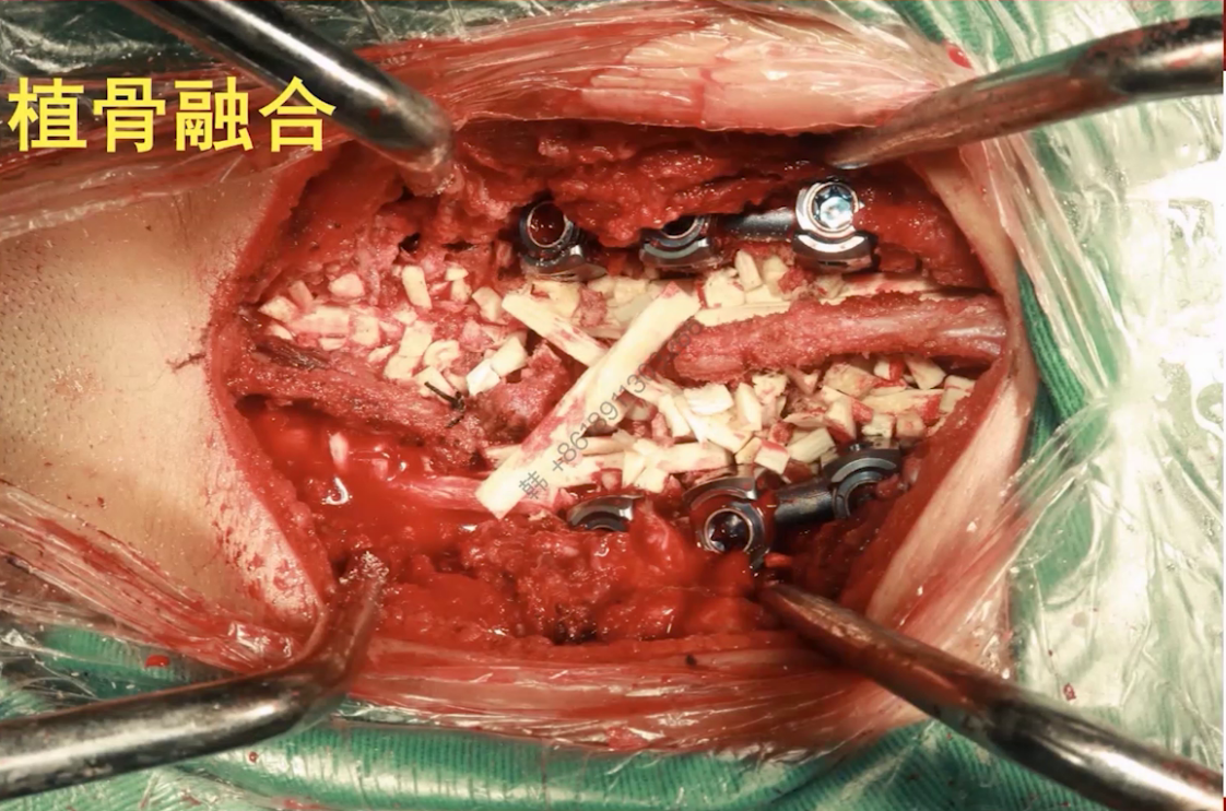 upfile 图片 22.png