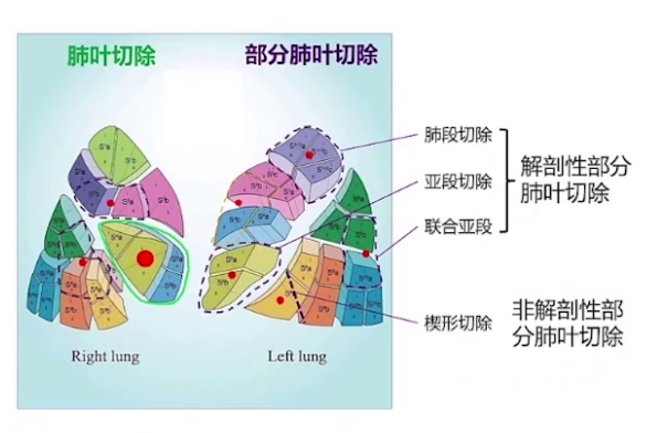 upfile 图片 17.png