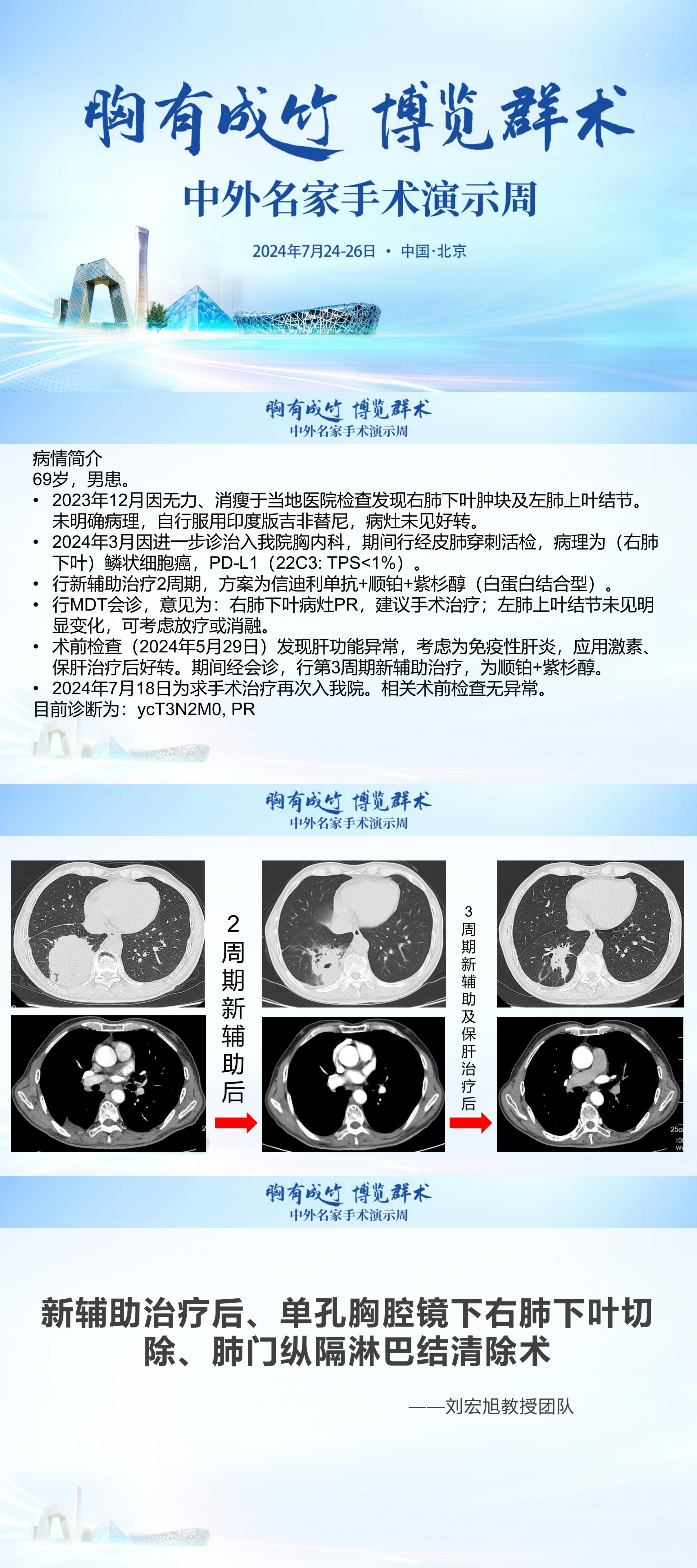 7.25-刘宏旭-手术演示-病例_00.jpg