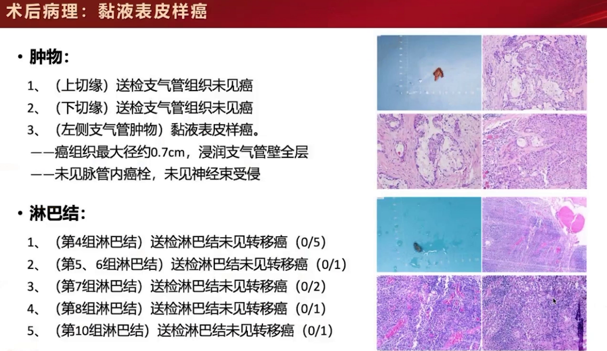 upfile 图片 10.png