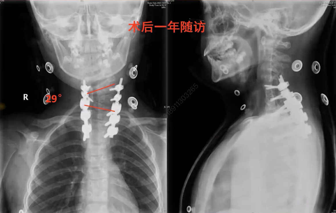 upfile 图片 28.png