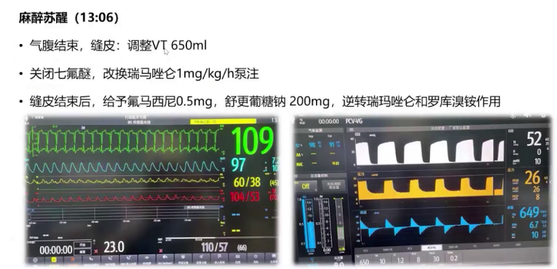 upfile 图片 22.png