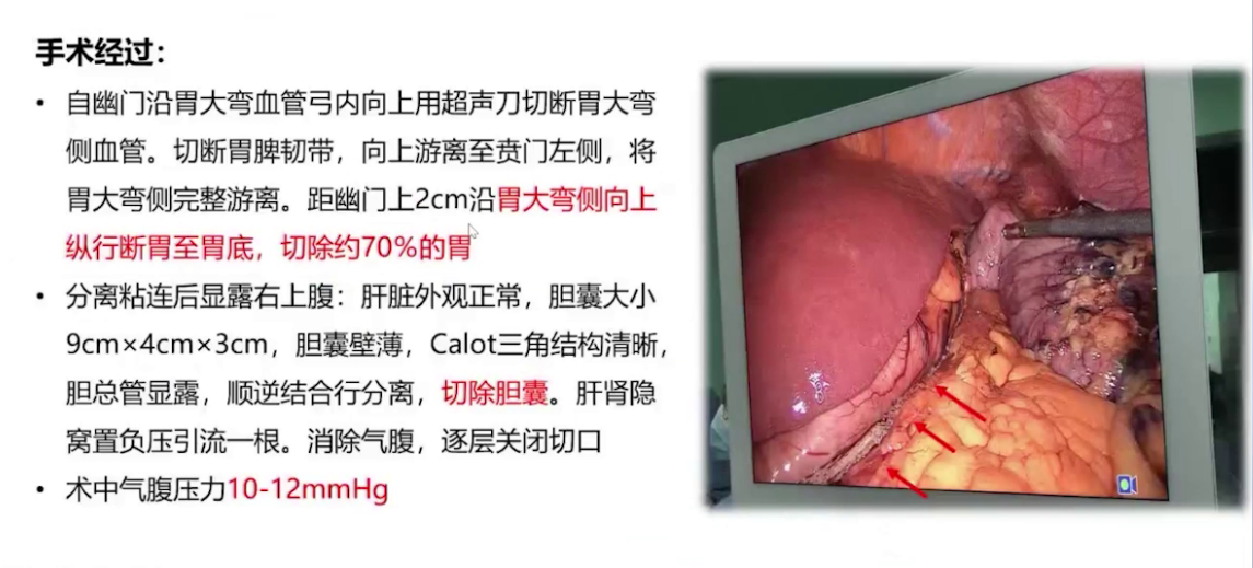 upfile 图片 20.png