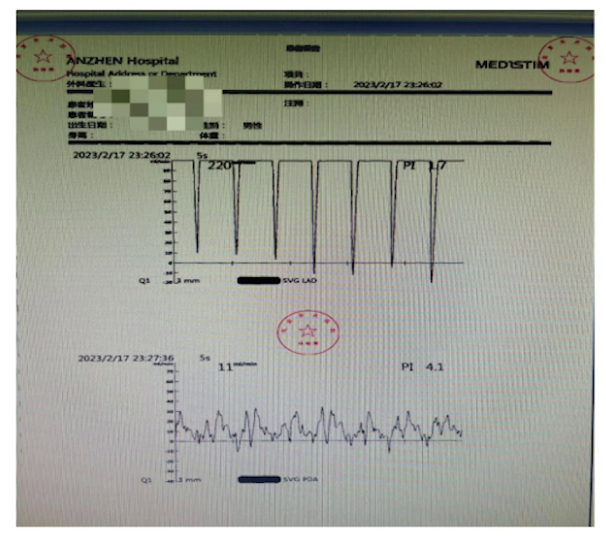 upfile 图片 11.png