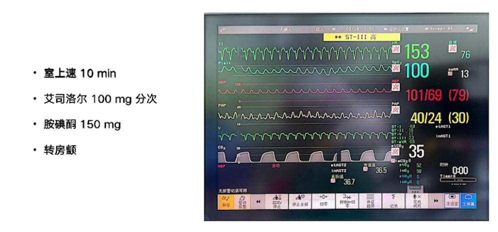upfile 图片 15.png