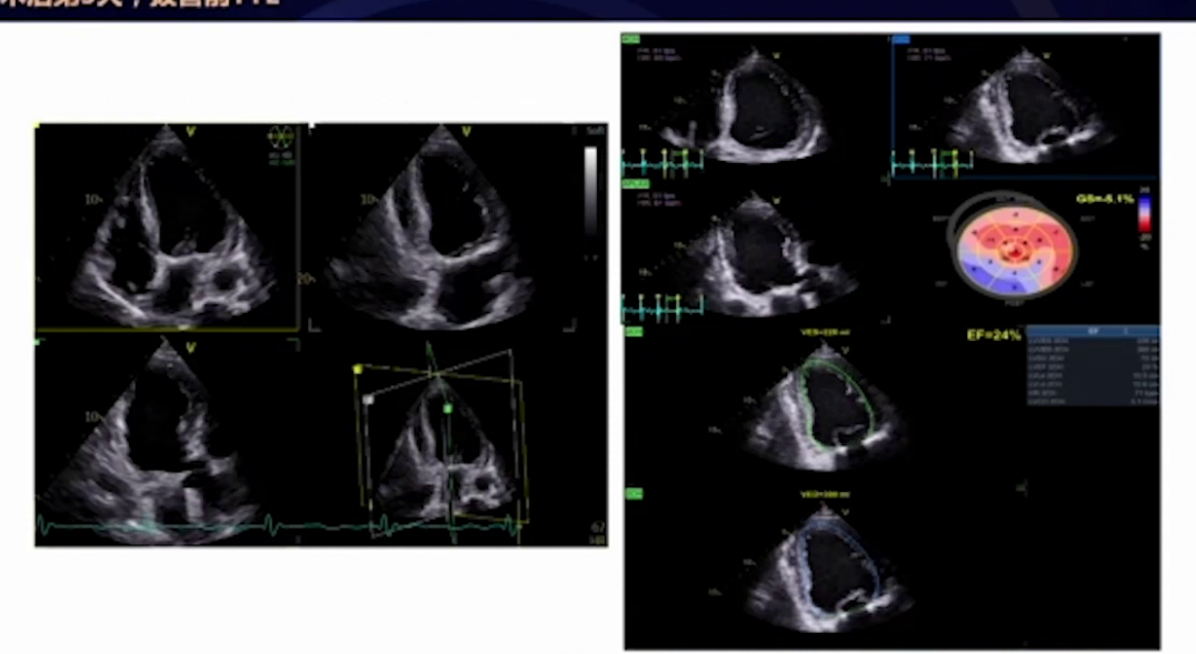 upfile 图片 20.png
