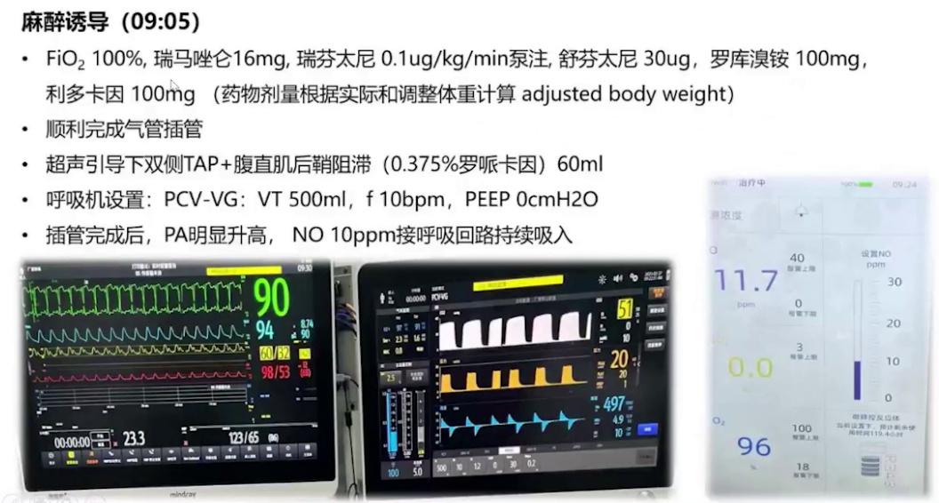 upfile 图片 15.png