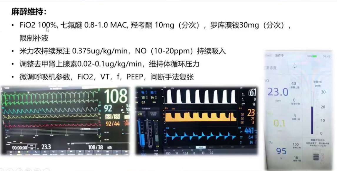 upfile 图片 17.png