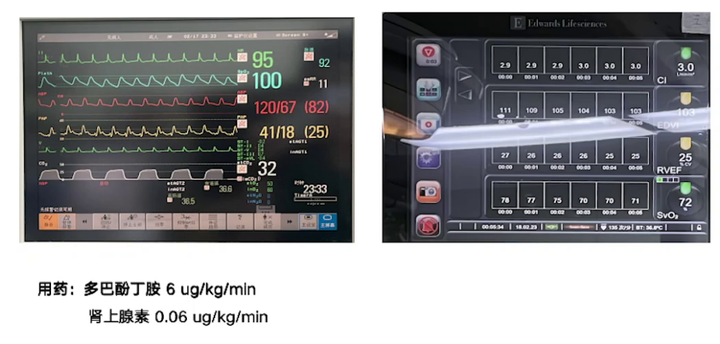 upfile 图片 13.png