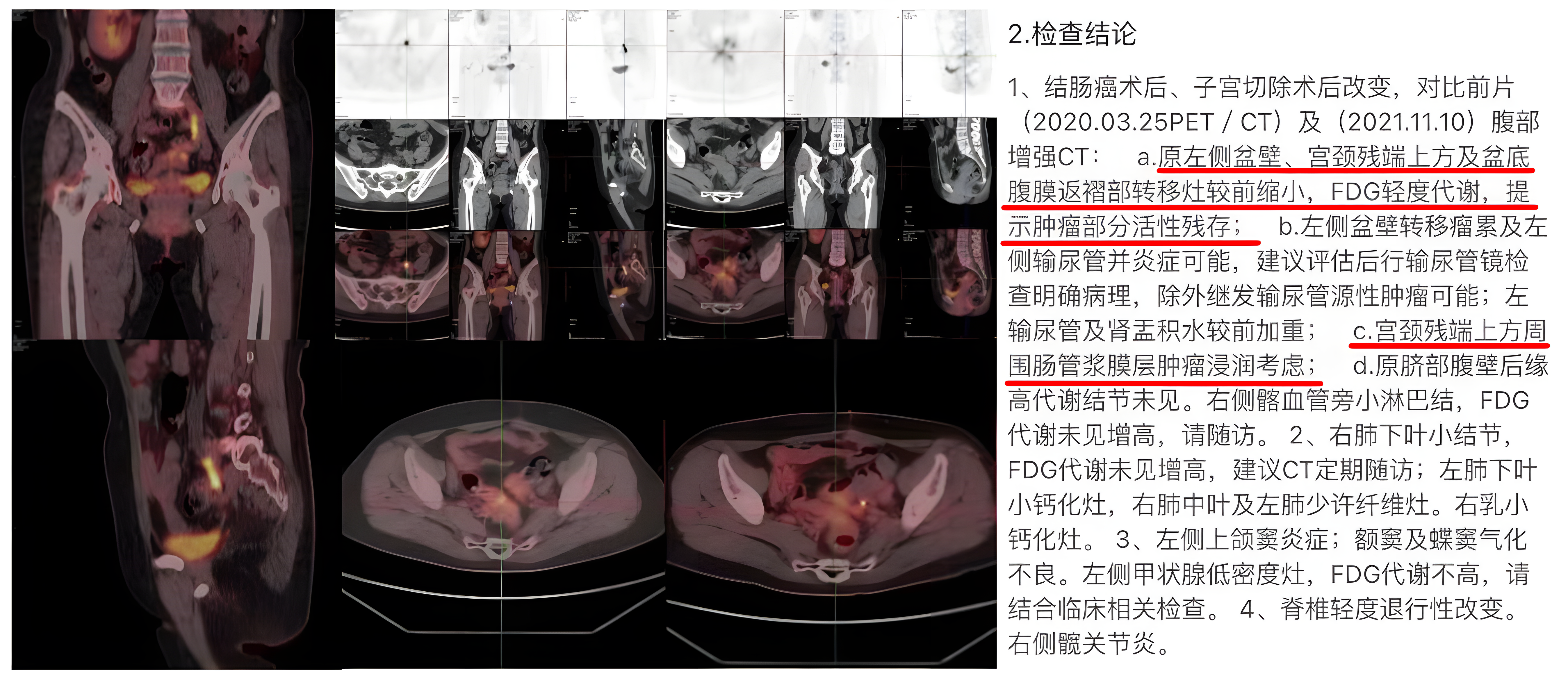 upfile 图片5_4x.png