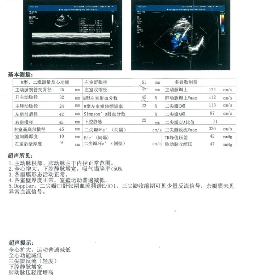 超声心动图报告（2月6日）.png