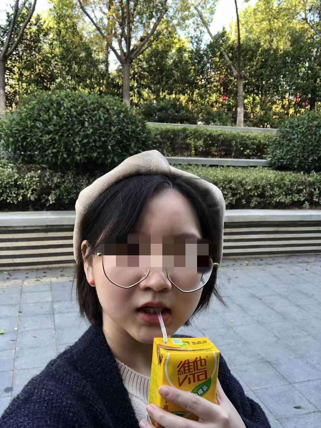 小江术后瘦到了45KG_副本.jpg
