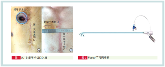 微信图片_20201113164019.png